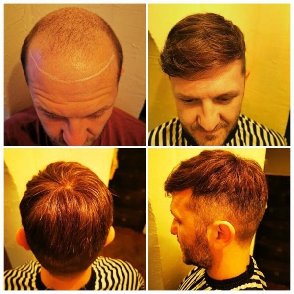 (New) Mens Toupee Australia Series French Lace Centre With PU Poly Skin Around Replacement Hair System 100% Human Hair